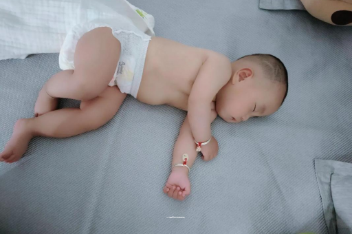 长治六个月宝宝眼睛散光